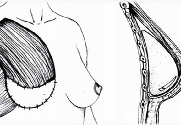 Native_0001_NATIVE3D 4