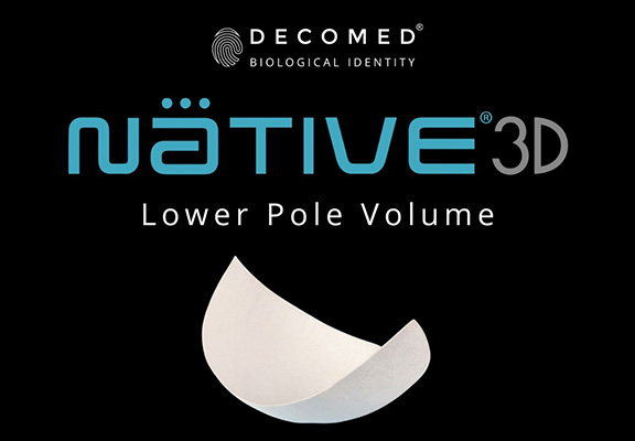 Native_0003_NATIVE3D 2